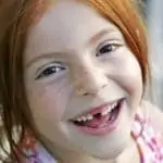 Little girl smiling with a missing front tooth