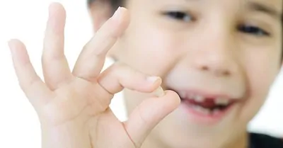 young boy holding his lost tooth