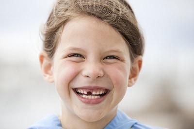 smiling young girl with missing front tooth